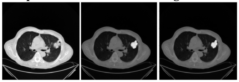 Radiografia